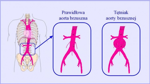 Zdjęcie ilustracyjne